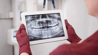 Radiografías dentales